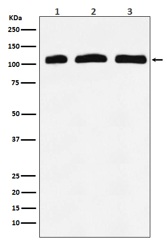 PI3 Kinase p110 delta Rabbit mAb